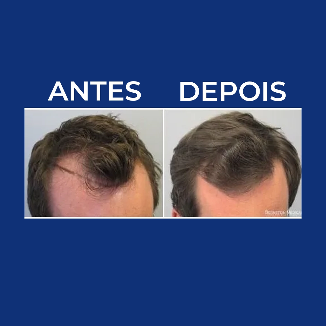 Pedro Almeida