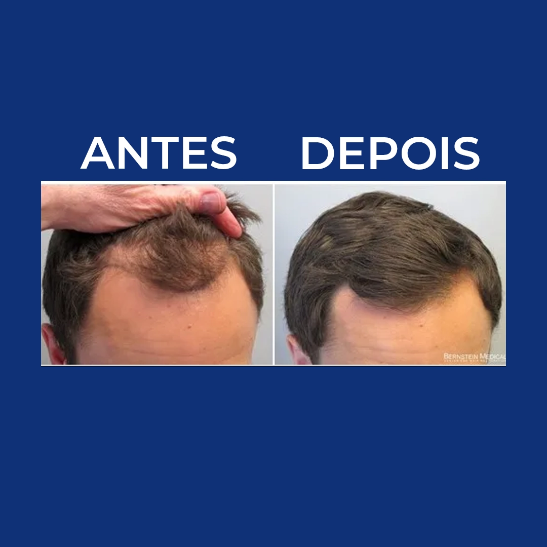 Diego Santos
